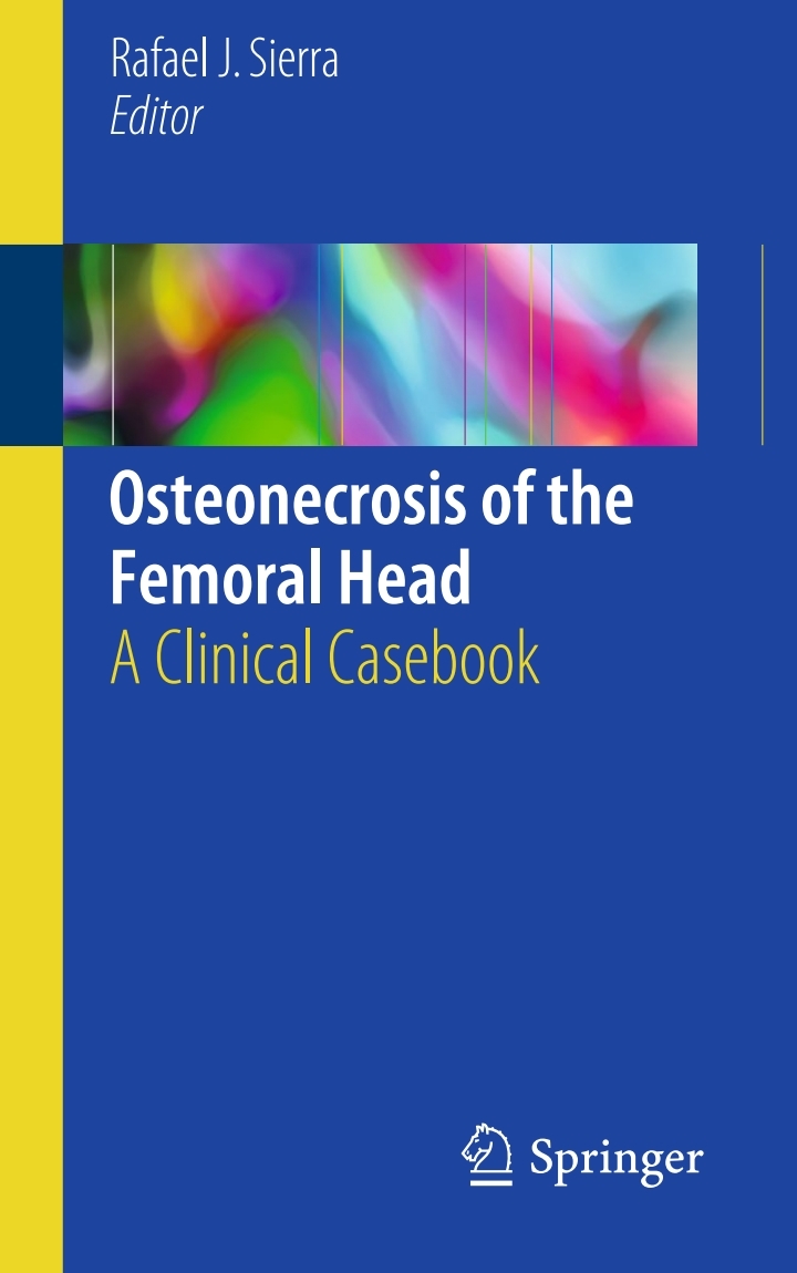 Osteonecrosis of the Femoral Head: A Clinical Cas