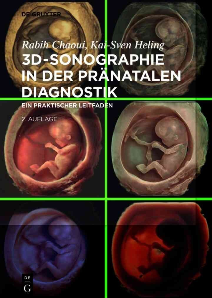 3D-Sonographie in der pränatalen Diagnostik: Ein praktischer Leitfaden eBook