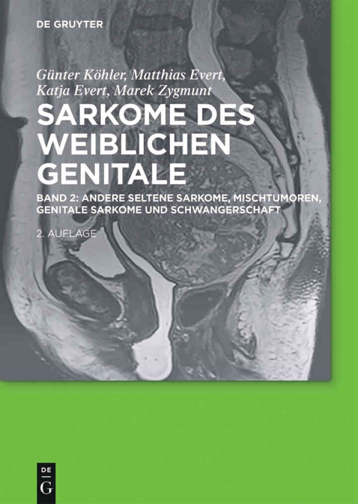 Andere seltene Sarkome, Mischtumoren, genitale Sarkome und Schwangerschaft eBook
