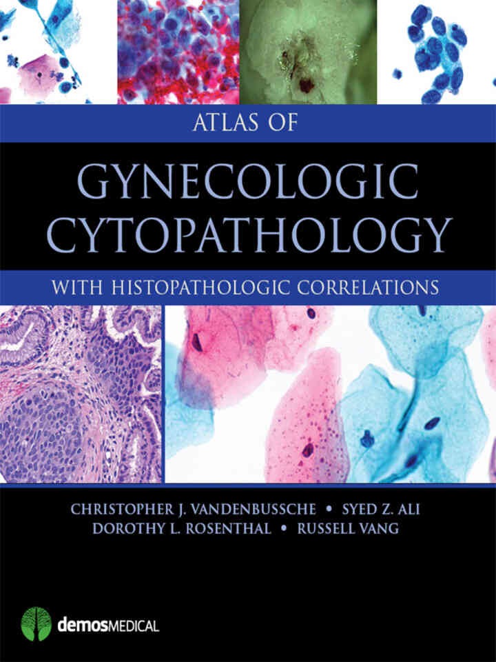 Atlas of Gynecologic Cytopathology: with Histopathologic Correlations eBook