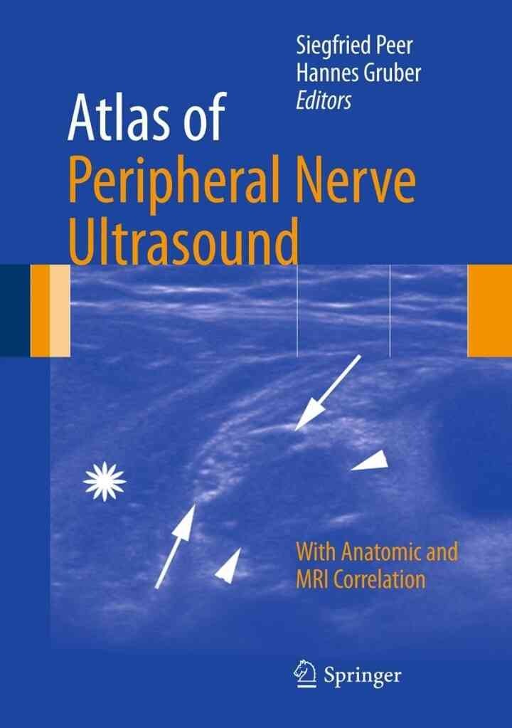 Atlas of Peripheral Nerve Ultrasound: With Anatomic and MRI Correlation eBook