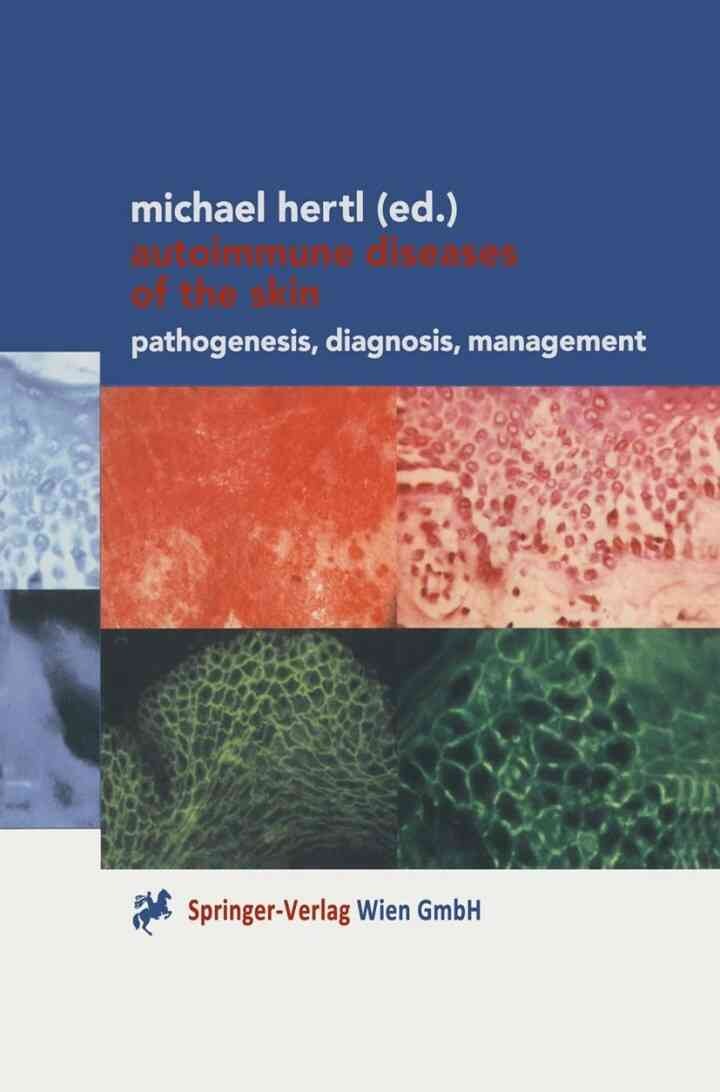 Autoimmune Diseases of the Skin: Pathogenesis, Diagnosis, Management, 1st Edition eBook