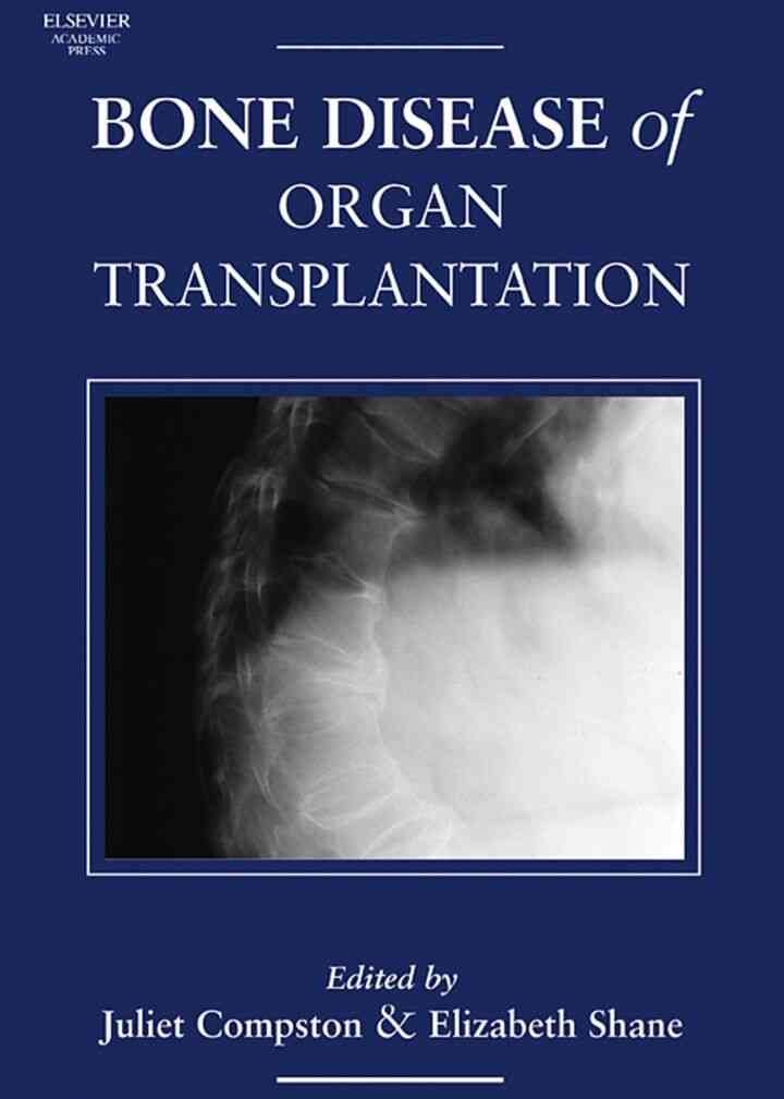 Bone Disease of Organ Transplantation eBook
