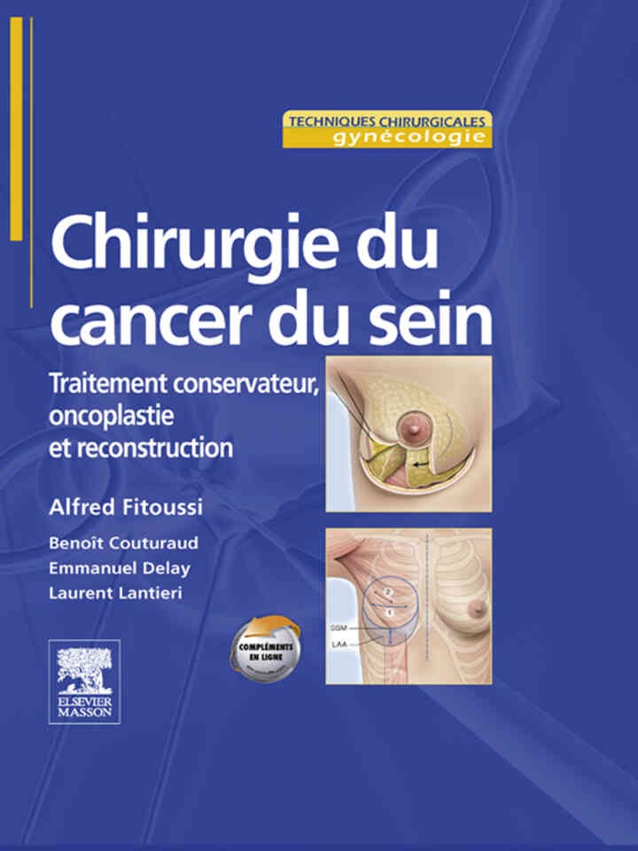 Chirurgie du cancer du sein: Traitement conservateur, oncoplastie et reconstruction eBook