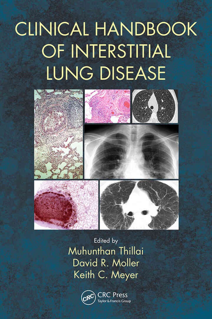 Clinical Handbook of Interstitial Lung Disease, 1st Edition eBook