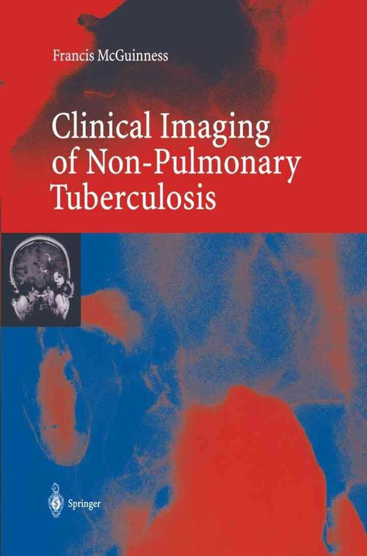 Clinical Imaging in Non-Pulmonary Tuberculosis eBook