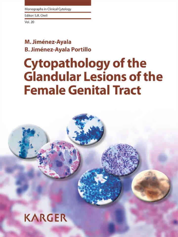 Cytopathology of the Glandular Lesions of the Female Genital Tract eBook