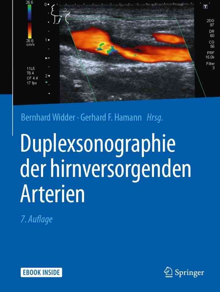 Duplexsonographie der hirnversorgenden Arterien eBook
