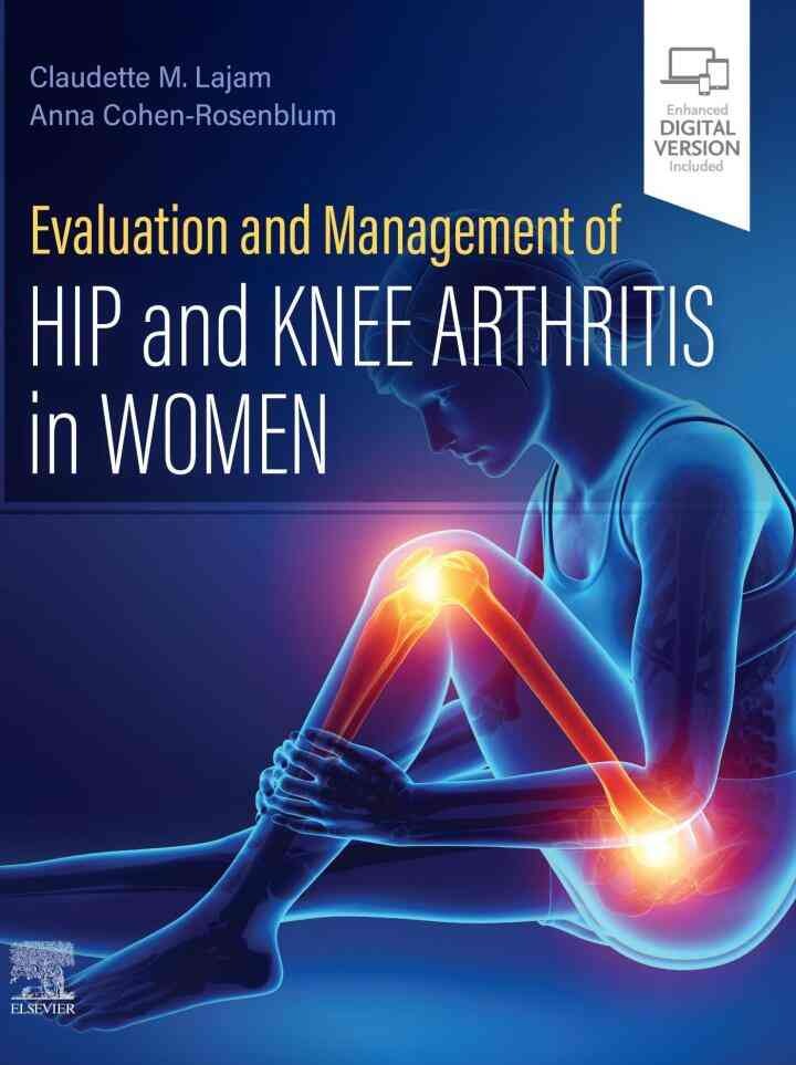 Evaluation and Management of Hip and Knee Arthritis in Women eBook