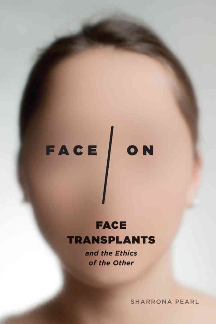 Face/On: Face Transplants and the Ethics of the Other, 1st Edition eBook