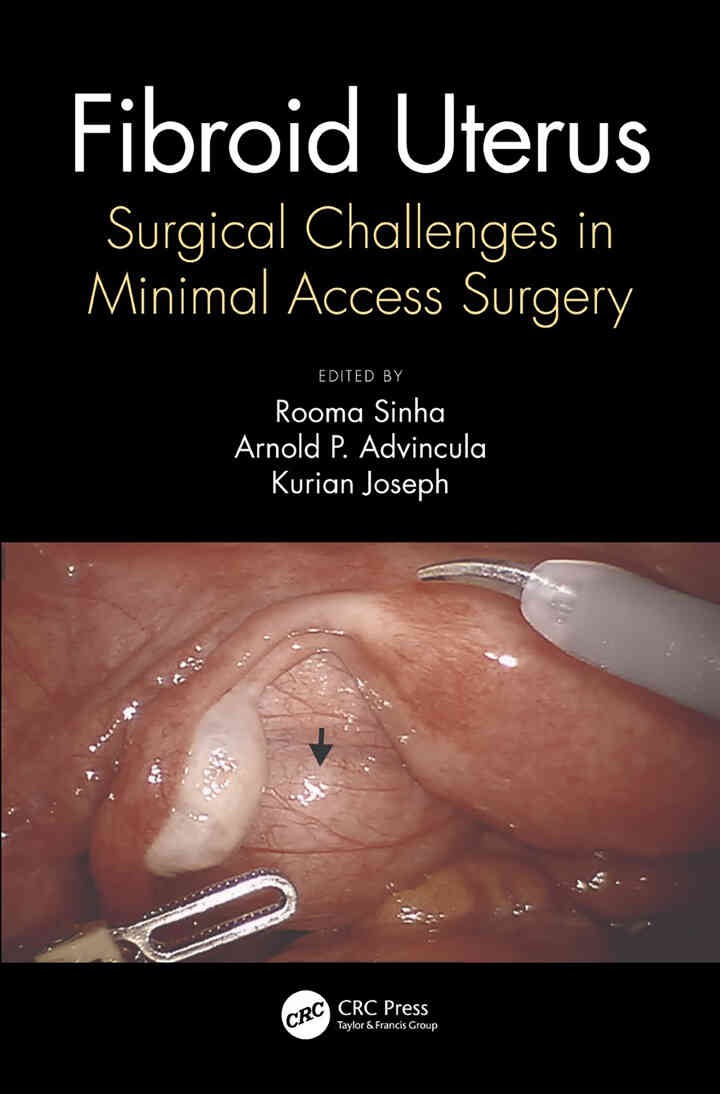 Fibroid Uterus: Surgical Challenges in Minimal Access Surgery eBook