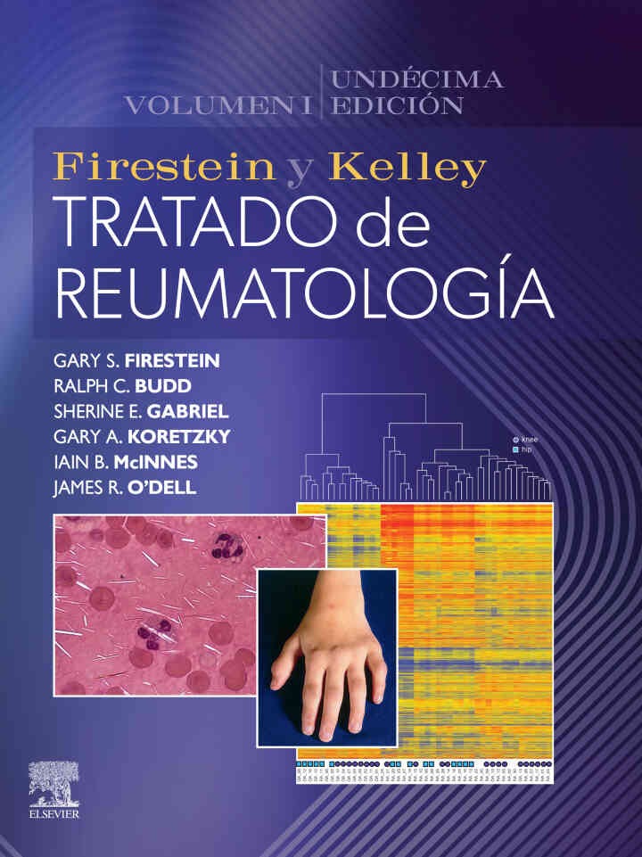 Firestein y Kelley. Tratado de reumatología, 11th Edition eBook