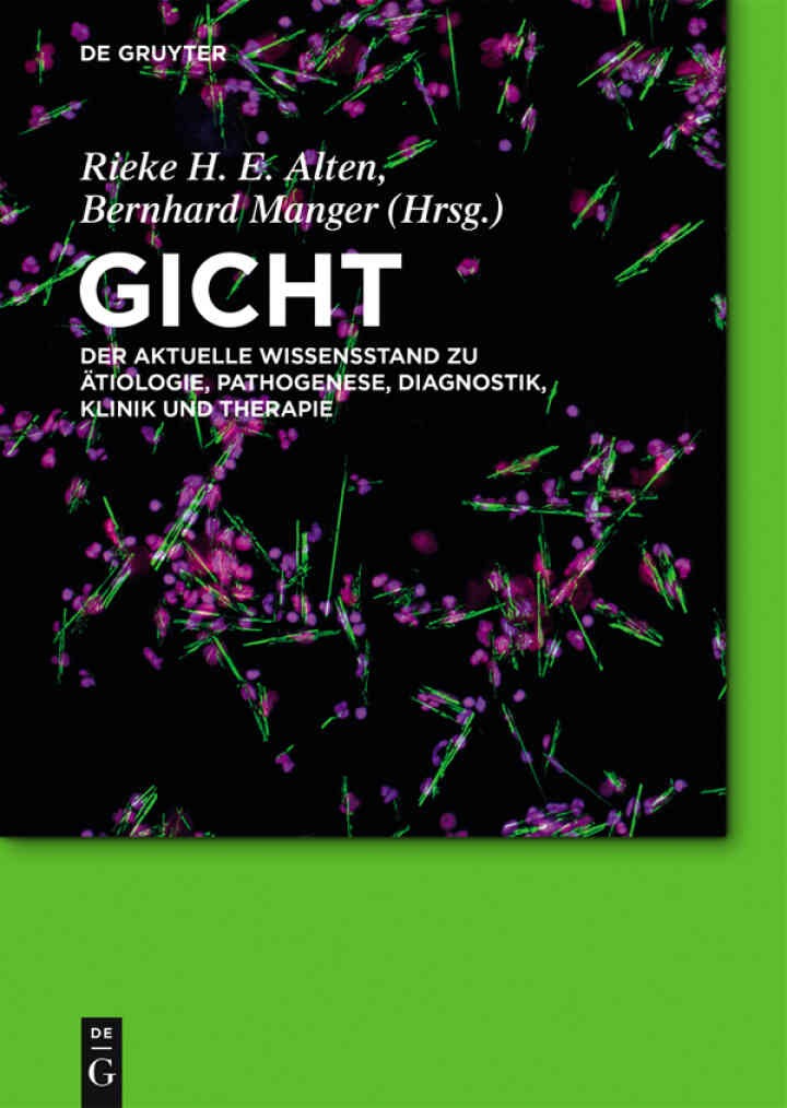 Gicht: Der aktuelle Wissensstand zu Ätiologie, Pathogenese, Diagnostik, Klinik und Therapie, 1st Edition eBook