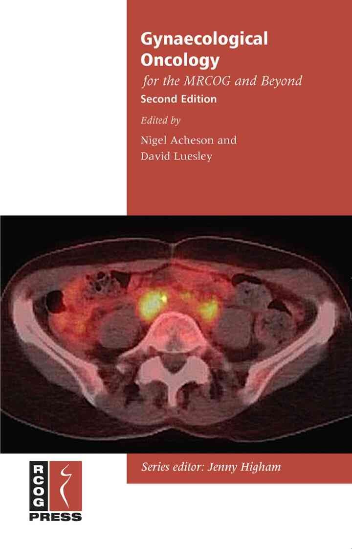 Gynaecological Oncology for the MRCOG and Beyond eBook
