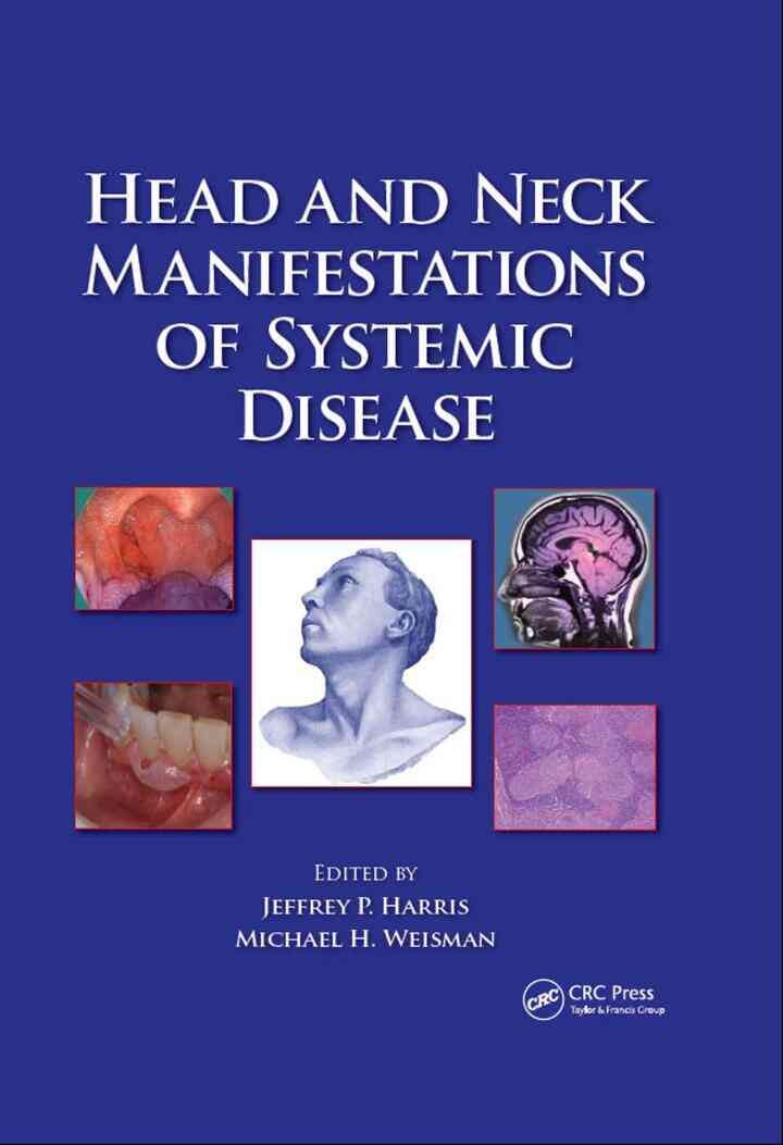 Head and Neck Manifestations of Systemic Disease, 1st Edition eBook
