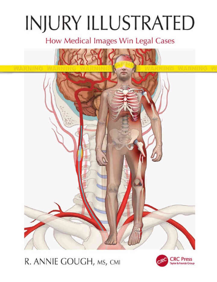 Injury Illustrated: How Medical Images Win Legal Cases eBook