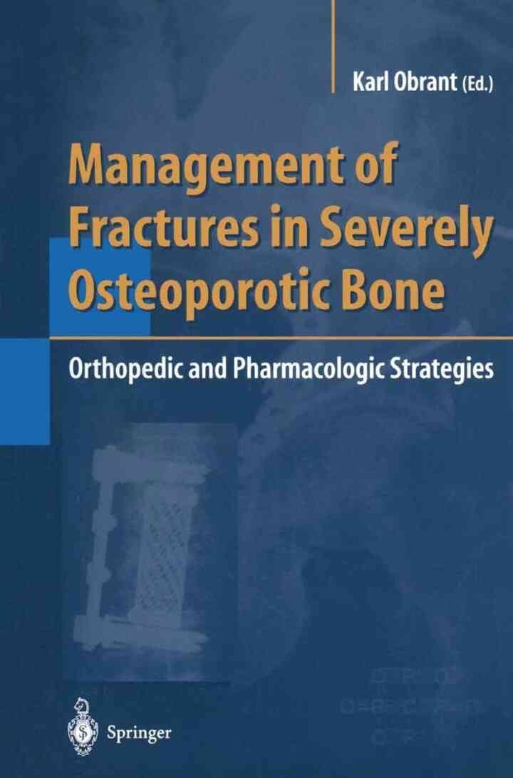 Management of Fractures in Severely Osteoporotic Bone: Orthopedic and Pharmacologic Strategies, 1st Edition eBook