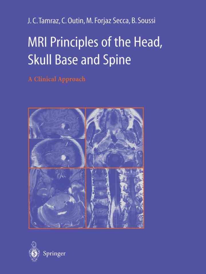 MRI Principles of the Head, Skull Base and Spine: A Clinical Approach eBook
