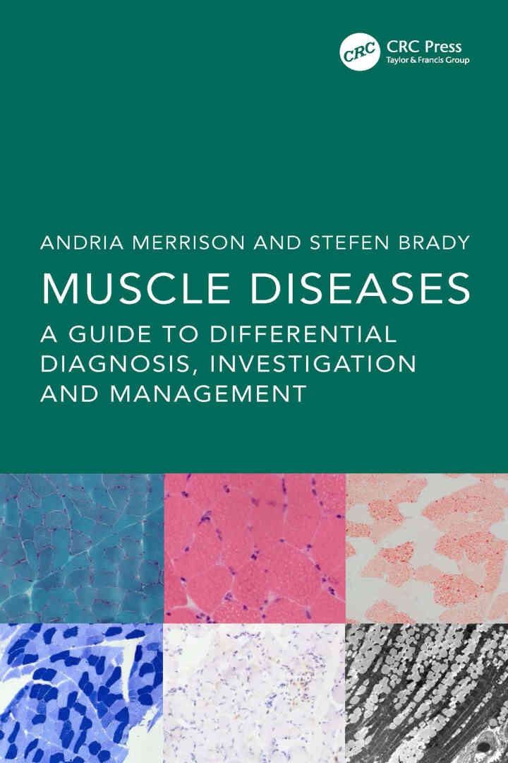 Muscle Diseases: A Guide to Differential Diagnosis, Investigation and Management, 1st Edition eBook
