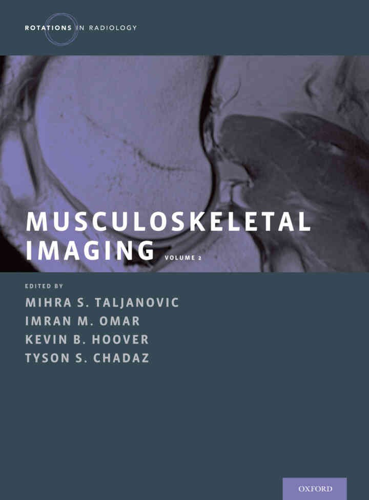 Musculoskeletal Imaging Volume 2: Metabolic, Infectious, and Congenital Diseases; Internal Derangement of the Joints; and Arthrography and Ultrasound, 1st Edition eBook