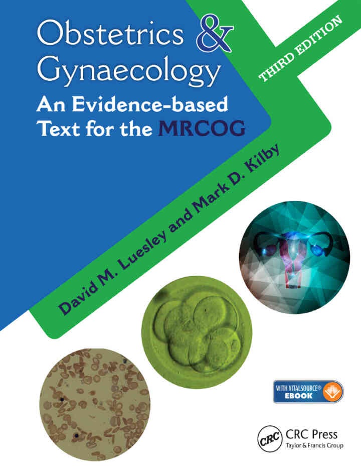Obstetrics & Gynaecology: An Evidence-based Text for MRCOG eBook