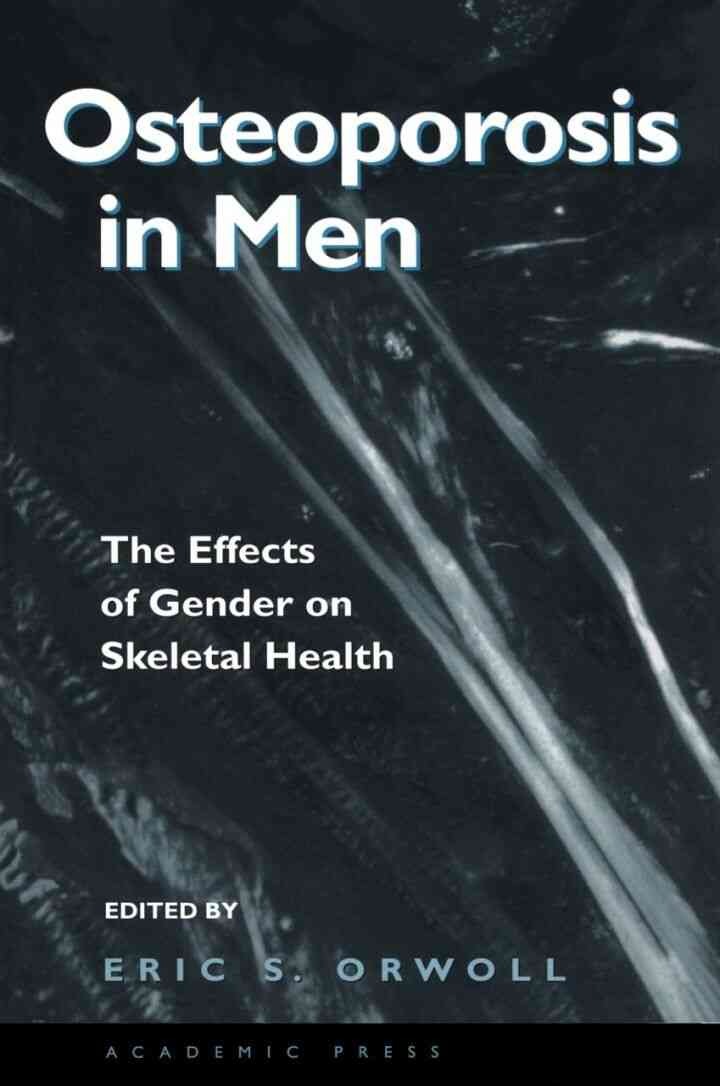 Osteoporosis in Men: The Effects of Gender on Skeletal Health eBook