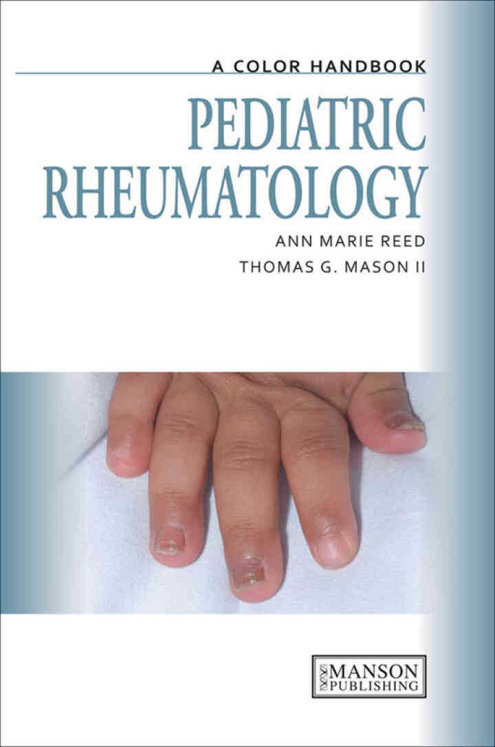 Pediatric Rheumatology: A Color Handbook, 1st Edition eBook