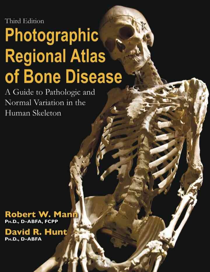 Photographic Regional Atlas of Bone Disease: "A Guide to Pathologic and Normal Variationin the Human Skeleton", 3rd Edition eBook