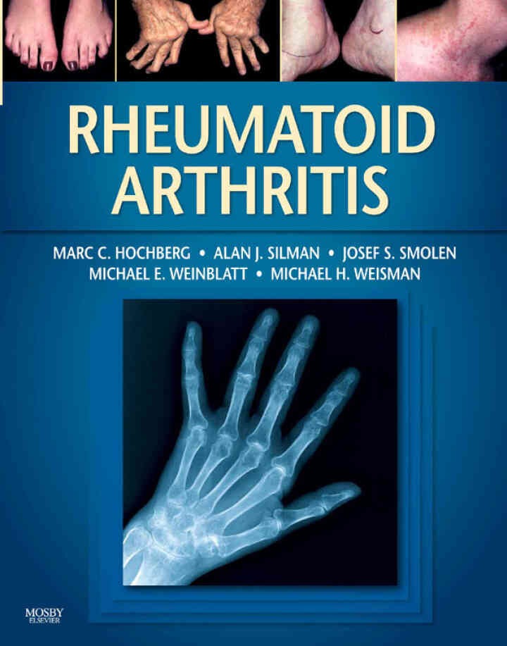 Rheumatoid Arthritis - Electronic, 1st Edition eBook
