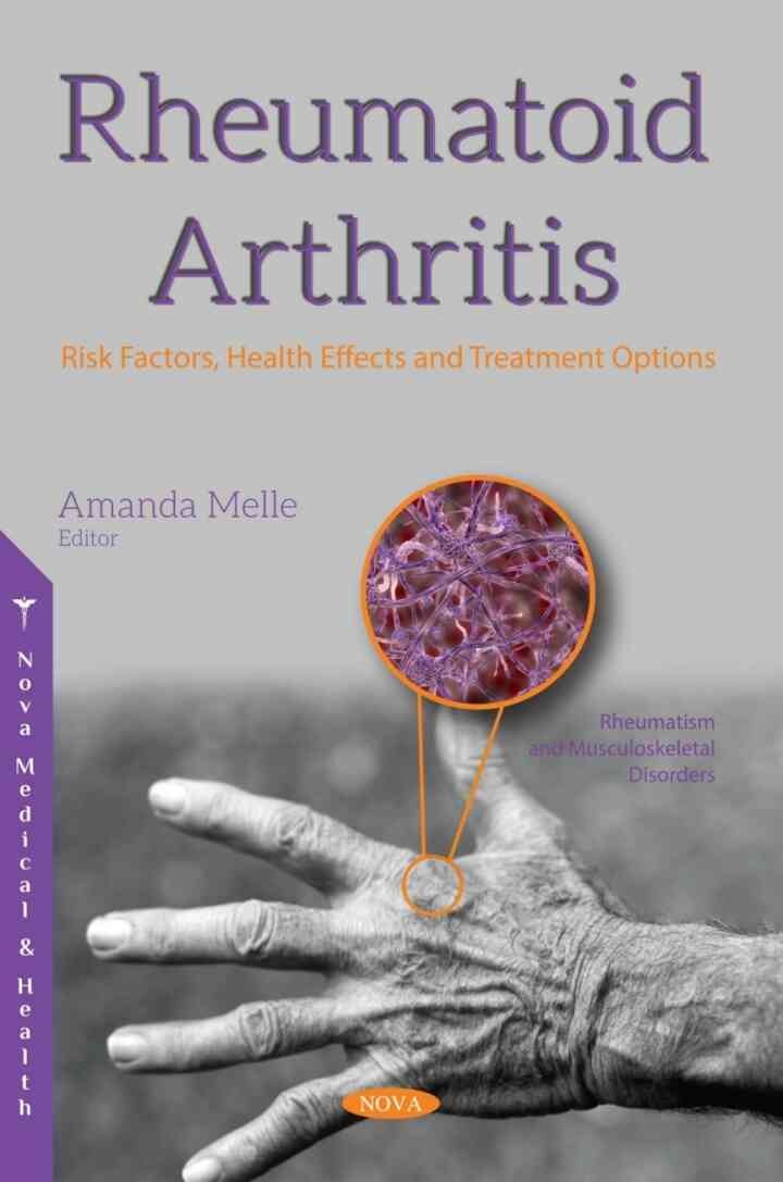 Rheumatoid Arthritis: Risk Factors, Health Effects and Treatment Options eBook