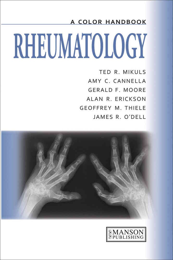 Rheumatology: A Color Handbook, 1st Edition eBook