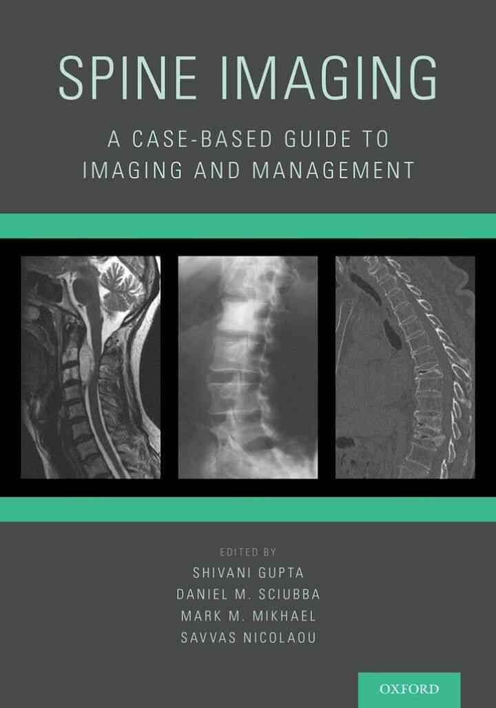 Spine Imaging: A Case-Based Guide to Imaging and Management, 1st Edition eBook