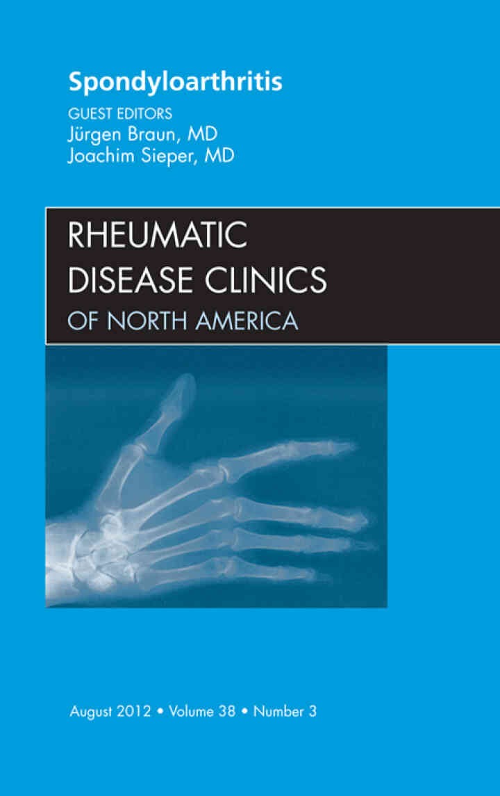 Spondyloarthropathies, An Issue of Rheumatic Disease Clinics eBook