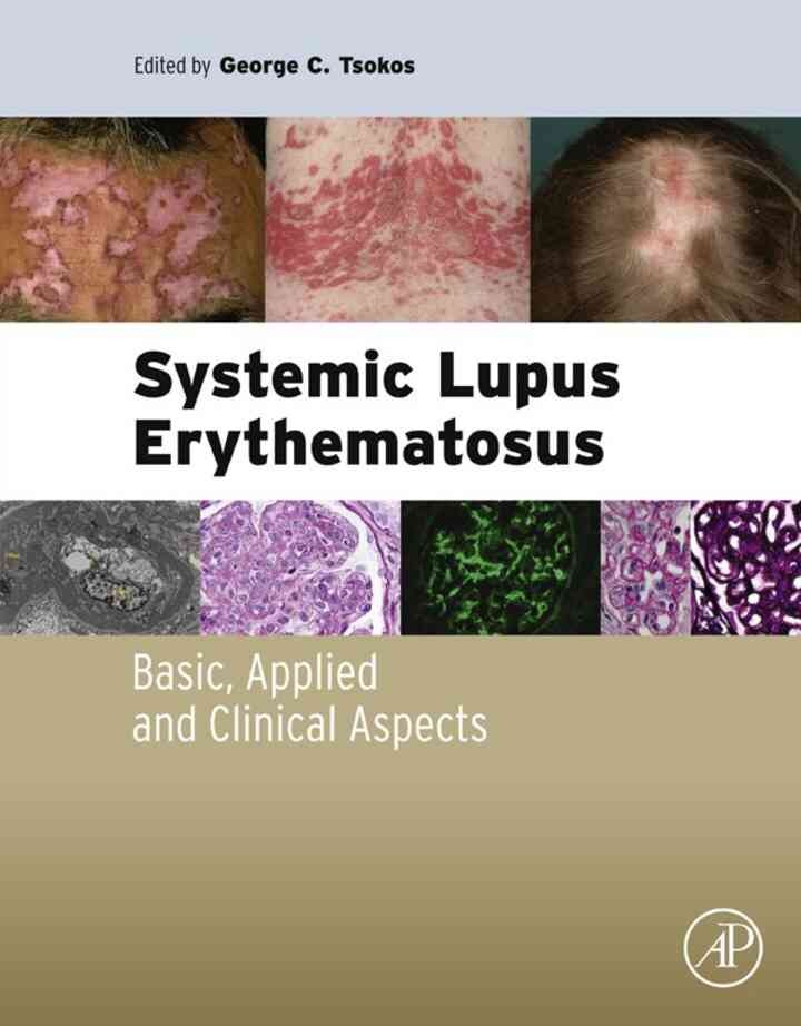 Systemic Lupus Erythematosus: Basic, Applied and Clinical Aspects eBook