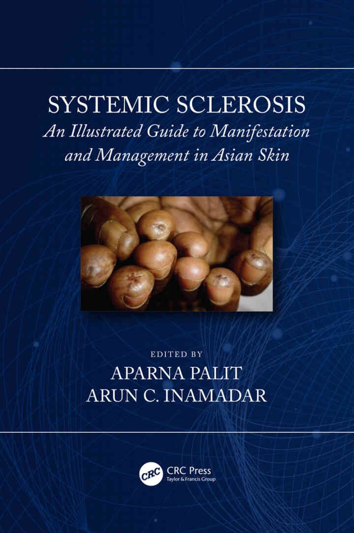 Systemic Sclerosis: An Illustrated Guide to Manifestation and Management in Asian Skin, 1st Edition eBook