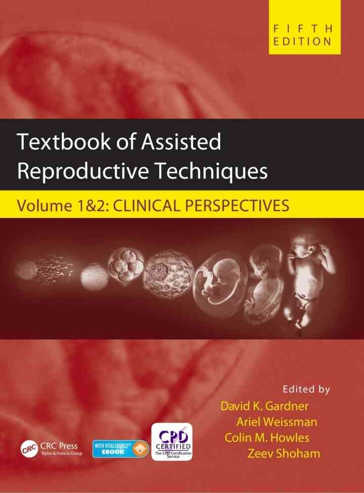Textbook of Assisted Reproductive Techniques: Two Volume Set eBook