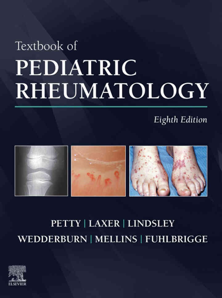 Textbook of Pediatric Rheumatology E-Book, 8th Edition eBook