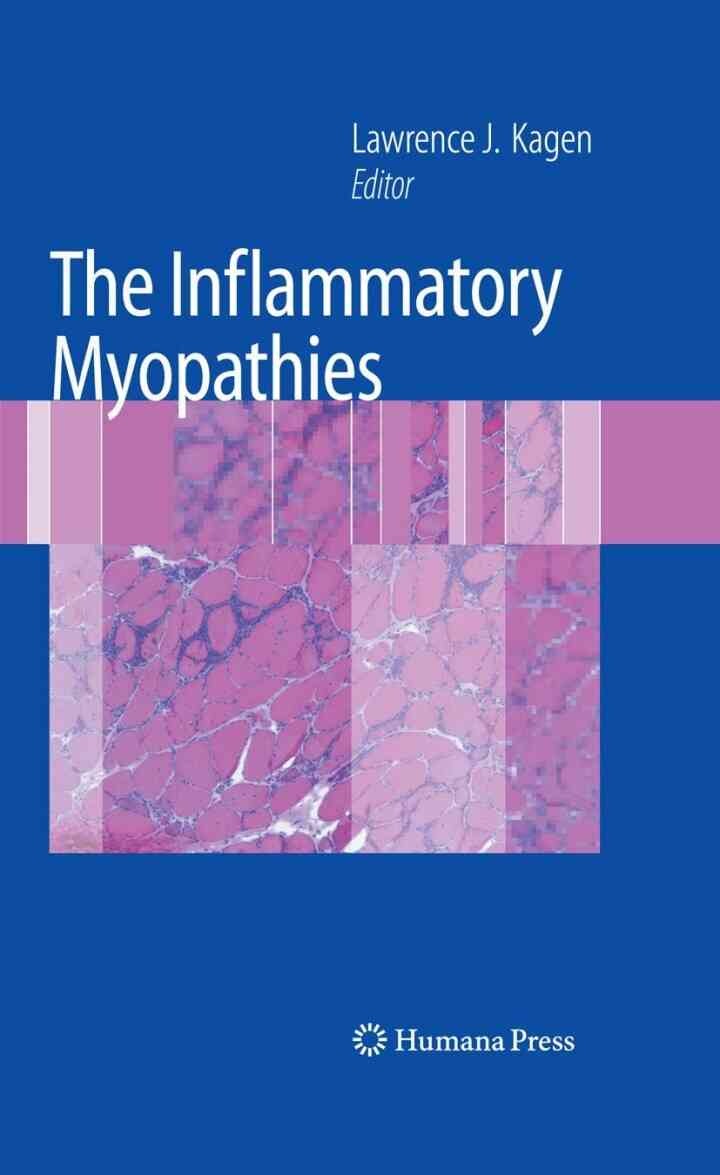 The Inflammatory Myopathies, 1st Edition eBook