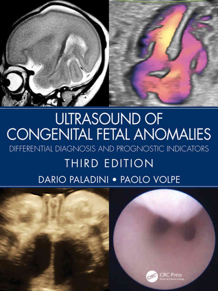Ultrasound of Congenital Fetal Anomalies: Differential Diagnosis and Prognostic Indicators eBook