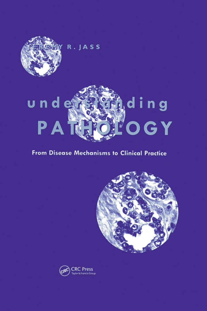 Understanding Pathology: From Disease Mechanism to Clinical Practice eBook